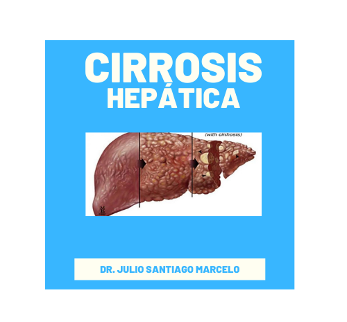  Cirrosis hepática